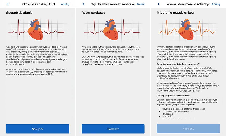 czujnik ekg w zegarku